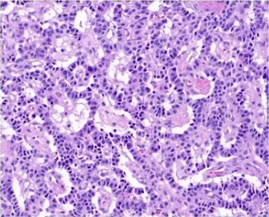 Histology specimen