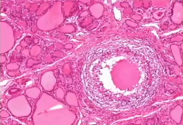 Histology (H&E stain)